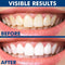 INSTANT TEETH WHITENING PEN Regular price